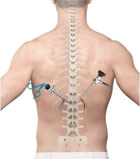 minimally-invasive